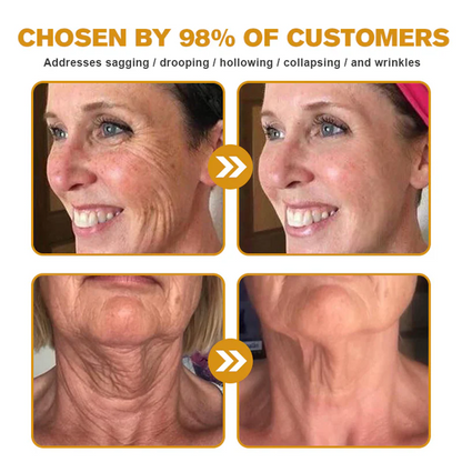 🪞TGA Approved: Ourlyard® Bee venom Pro Comprehensive Cream — 🔥Limited Time 80% OFF🔥