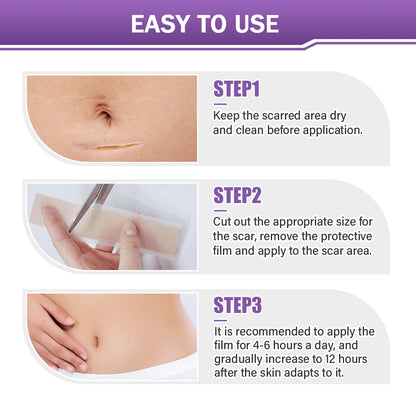 ✅Official Store |Ourlyard® Hyaluronic Acid Nano Microneedle Repair Tape🏥(Treatment of old and new scars, reduction of surgical scars, stretch marks, keloids, acne, burns, warts, dermatomes and varicose veins)