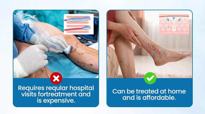 🌈🌈Ourlyard® VeinGuard Herbal Spray-✅ Clinically proven to eliminate varicose veins in just 7 days! (🔥Limited Time 80% OFF🔥)