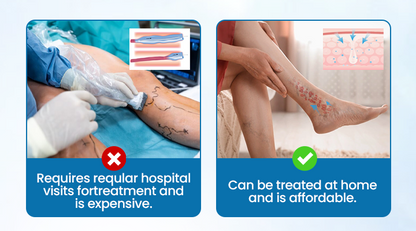 🌈🌈Ourlyard® VeinGuard Herbal Spray-✅ Clinically proven to eliminate varicose veins in just 7 days! (🔥Limited Time 80% OFF🔥)