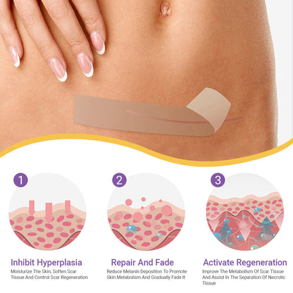 ✅Official Store |Ourlyard® Hyaluronic Acid Nano Microneedle Repair Tape🏥(Treatment of old and new scars, reduction of surgical scars, stretch marks, keloids, acne, burns, warts, dermatomes and varicose veins)