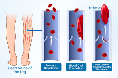 🌈🌈Ourlyard® VeinGuard Herbal Spray-✅ Clinically proven to eliminate varicose veins in just 7 days! (🔥Limited Time 80% OFF🔥)