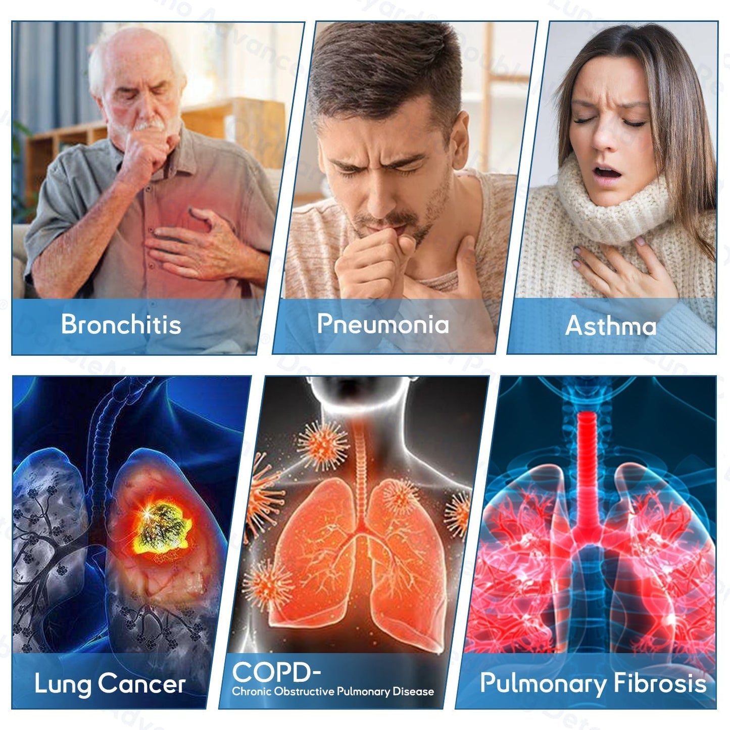 🔥🔥TGA Approved|Zvoevo® DoubleNano COPD Relief Patch (🍁💝 Cough, wheezing, shortness of breath, sputum, stuffy nose, bronchitis, bronchitis, allergy symptoms, lung discomfort🫁)