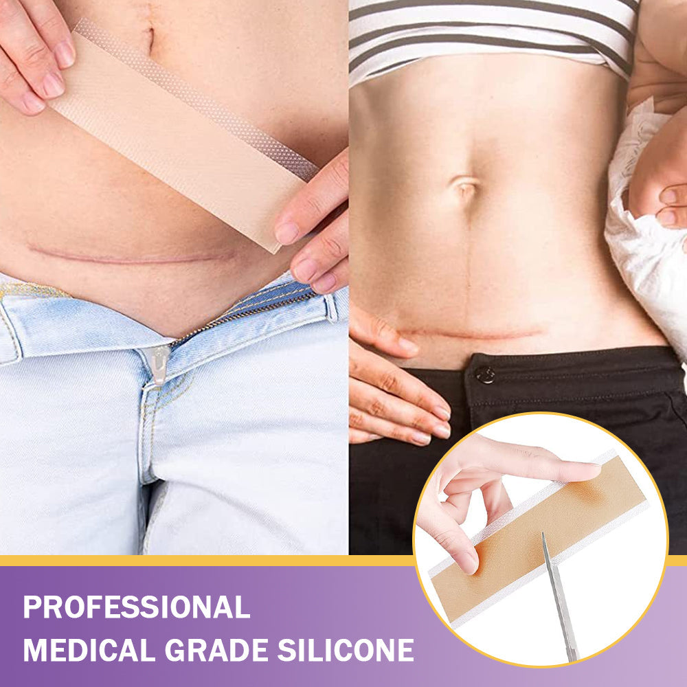 ✅Official Store |Ourlyard® Hyaluronic Acid Nano Microneedle Repair Tape🏥(Treatment of old and new scars, reduction of surgical scars, stretch marks, keloids, acne, burns, warts, dermatomes and varicose veins)