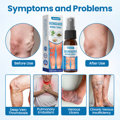 🌈🌈Ourlyard® VeinGuard Herbal Spray-✅ Clinically proven to eliminate varicose veins in just 7 days! (🔥Limited Time 80% OFF🔥)