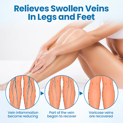 🌈🌈Ourlyard® VeinGuard Herbal Spray-✅ Clinically proven to eliminate varicose veins in just 7 days! (🔥Limited Time 80% OFF🔥)