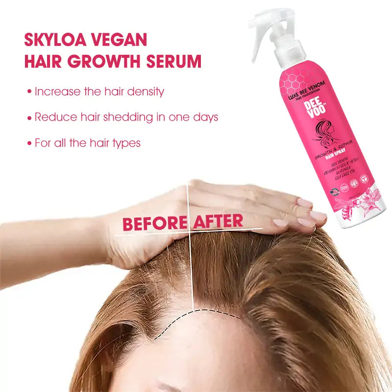 ✨️DeeVoo™   Luxe Bee venom Scalp Treatment HairGrᴏᴡth Hair Spray(Hurry, 80% OFF - Only 30 minutes left 🫧)